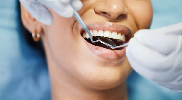 Best Emergency Gum Treatment in Green Bay, WI