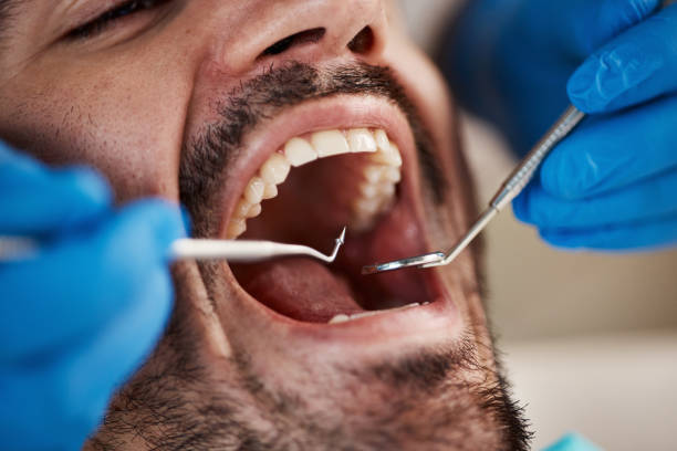 Best Emergency Dental Care for Broken or Chipped Teeth in Green Bay, WI